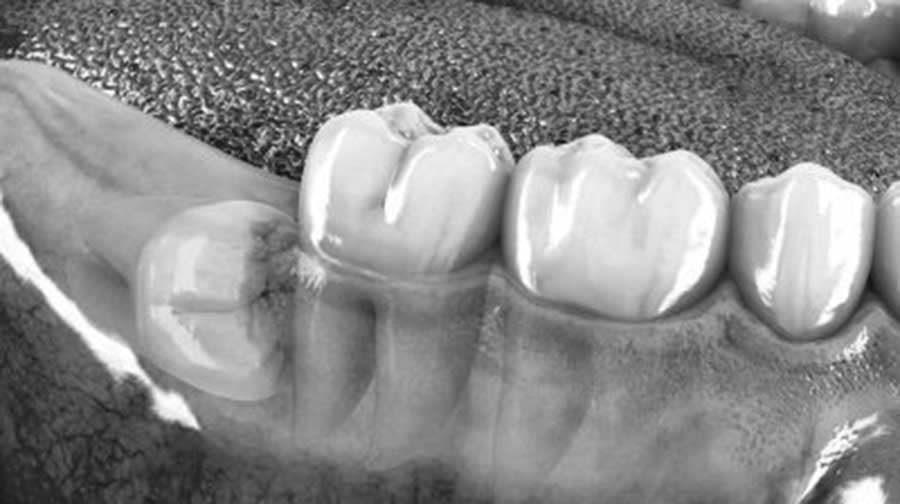 Cirurgia-Oral-Barcelona