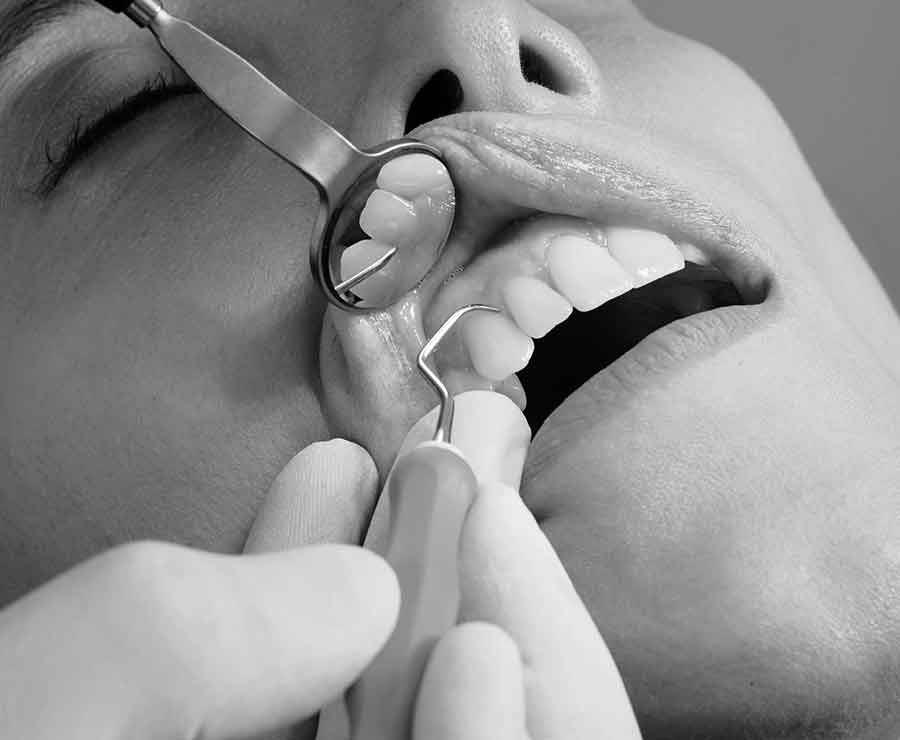 conservative dentistry process