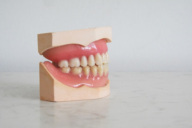 manchas blancas en los dientes