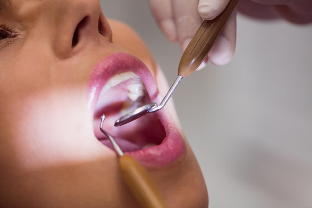 curetaje dental ns