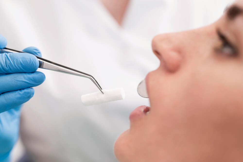 curetaje dental que es