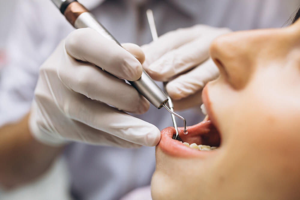 endodoncia